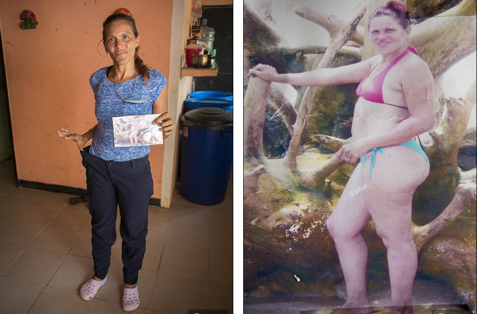 Marlene Gaspar passou tanta fome que ficou magra e não tem mais forças para participar dos treinamentos paramilitares do governo